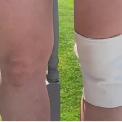 knee_3__92036