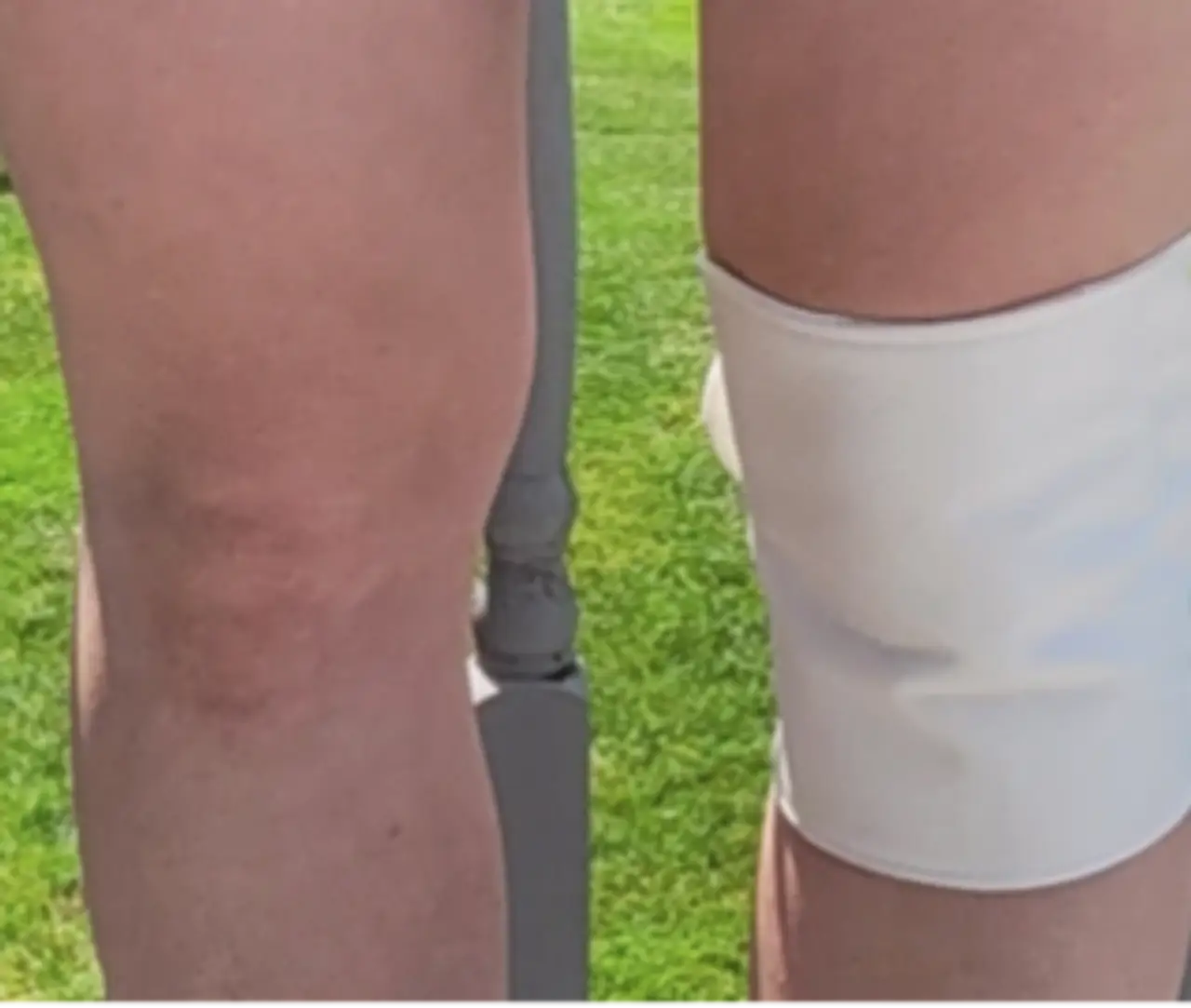 knee_3__92036
